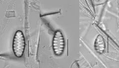 Staurosirella martyi thumbnail 2