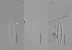 Fragilaria vaucheriae thumbnail 1