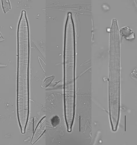Ulnaria contracta