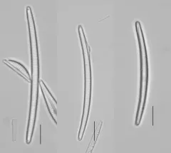 Eunotia bilunaris thumbnail 3