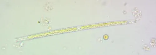 Gonatozygon brebissonii