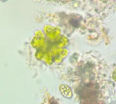 Sorastrum spinulosum thumbnail 3