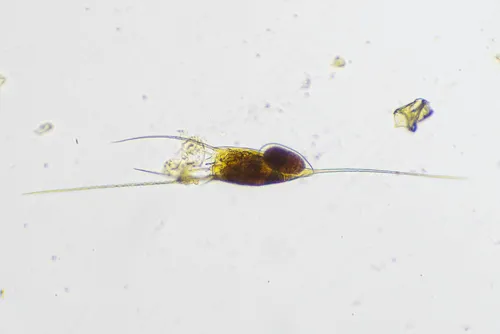 Kellicottia longispina