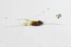 Kellicottia longispina thumbnail 1
