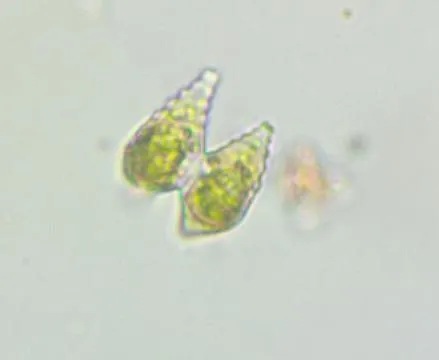 Staurastrum polymorphum