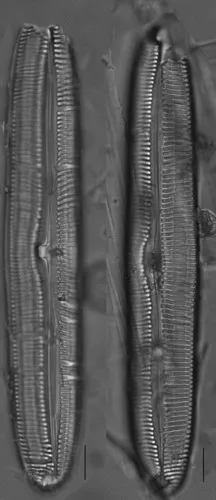 Pinnularia turnerae