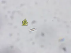 Staurastrum punctulatum thumbnail 3