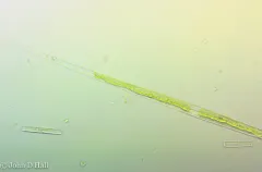 Closterium aciculare thumbnail 3