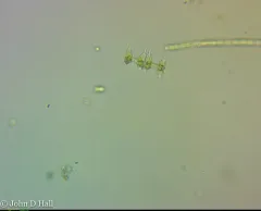 Staurodesmus cuspidatus thumbnail 4