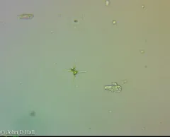 Staurastrum tetracerum thumbnail 4