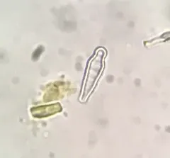 Meridion constrictum thumbnail 2