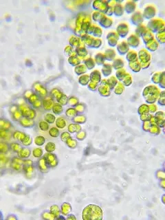 Tetraspora gelatinosa thumbnail 1