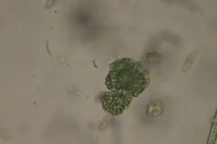 Woronichinia compacta thumbnail 3
