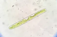 Haplotaenium minutum thumbnail 1