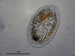 Frontonia acuminata thumbnail 1