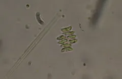 Tetradesmus obliquus thumbnail 3