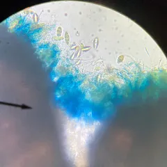 Lithothelium hyalosporum thumbnail 1