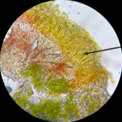 Chewing Gum Lichen thumbnail 4