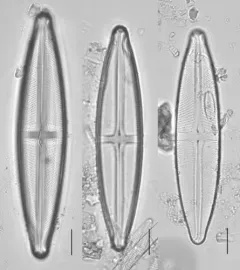 Stauroneis gracilis thumbnail 2