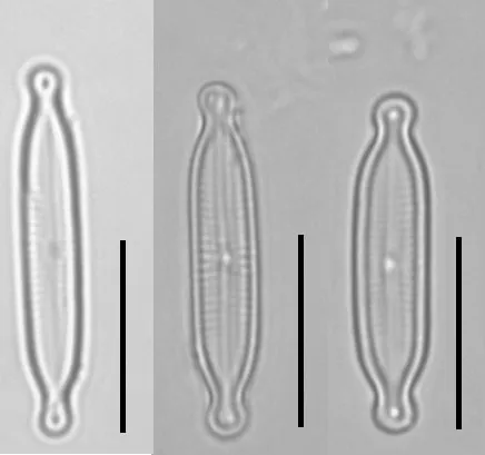 Encyonopsis hustedtii