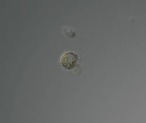 Choanocystis aculeata