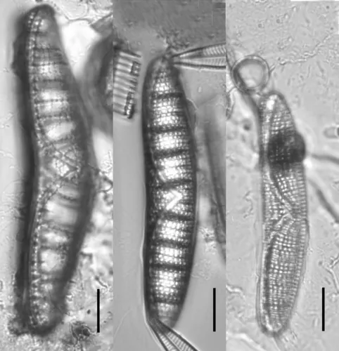 Epithemia alpestris