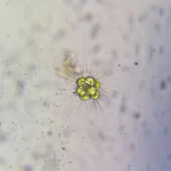 Micractinium pusillum thumbnail 4