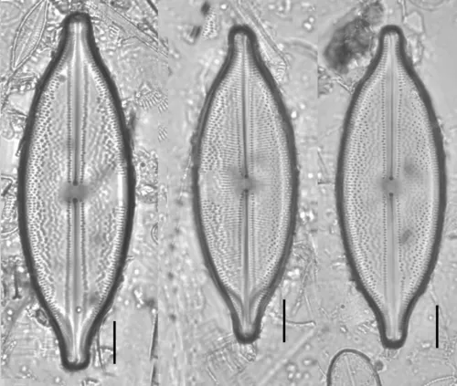 Anomoeoneis sphaerophora