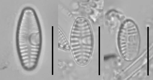 Planothidium frequentissimum