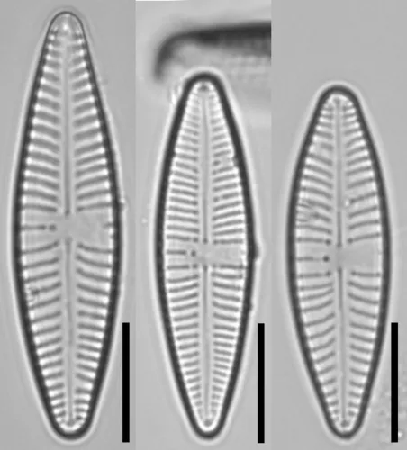 Gomphonema angustatum