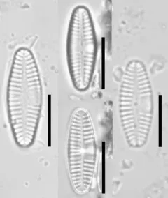 Planothidium lanceolatum thumbnail 2