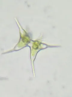 Staurodesmus cuspidatus thumbnail 2