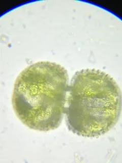 Cosmarium dentatum thumbnail 1