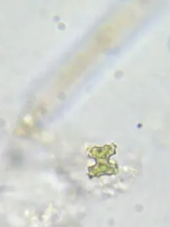 Cosmarium regnesi thumbnail 2