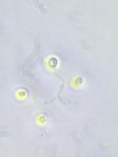 Hindakia tetrachotoma