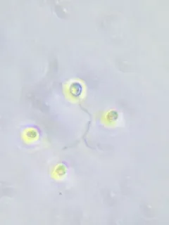 Hindakia tetrachotoma thumbnail 1