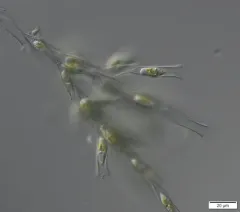 Dinobryon cylindricum thumbnail 3