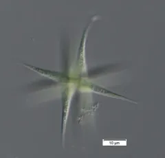 Ankistrodesmus falcatus thumbnail 3