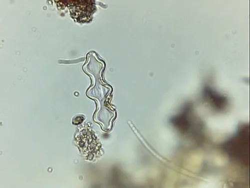 Caloneis trinodis
