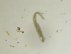 Spirostomum minus thumbnail 2