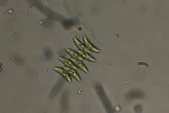 Tetradesmus dimorphus thumbnail 2