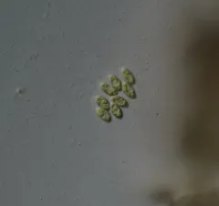 Scenedesmus obtusus thumbnail 1