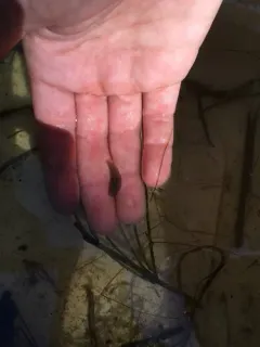 Glossiphonia complanata thumbnail 3