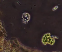 Parapediastrum biradiatum thumbnail 2