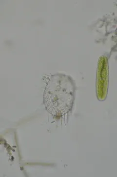 Euglypha strigosa thumbnail 1