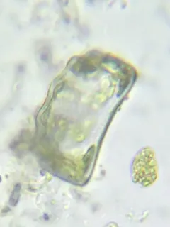 Eunotia tetraodon thumbnail 3