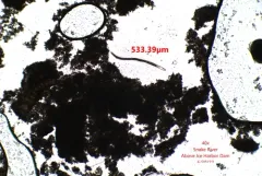 Spirostomum minus thumbnail 1