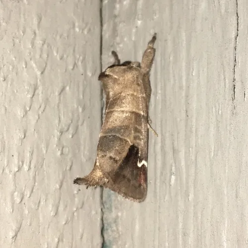Sigmoid Prominent