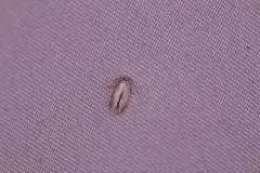 Gooseberry Barkminer Moth thumbnail 4
