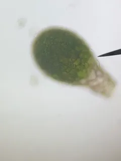 Difflugia pyriformis thumbnail 2